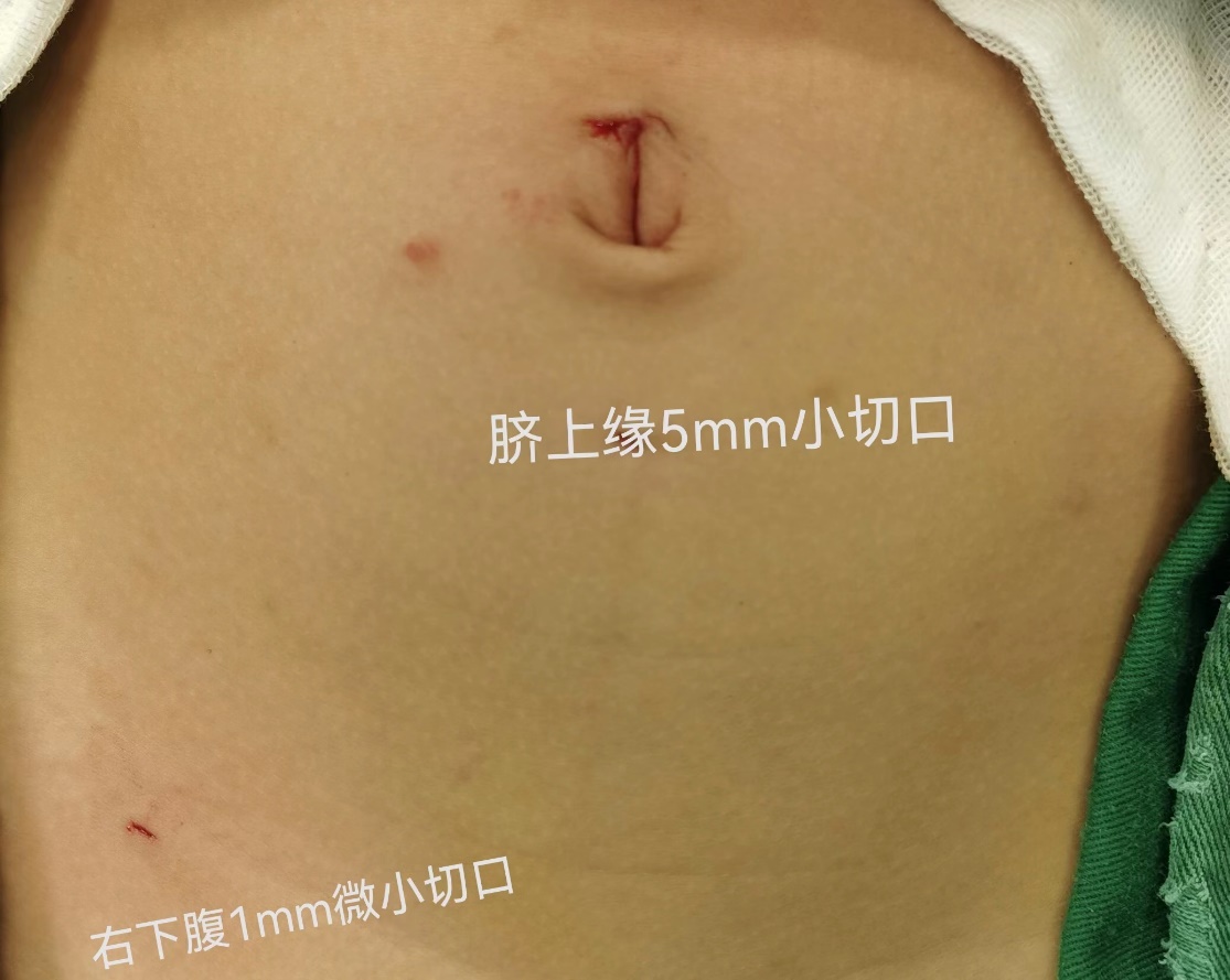 Picture 1