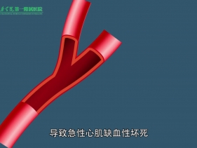 医院胸痛中心动漫