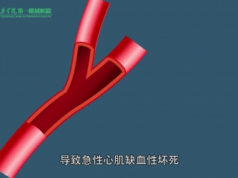 医院胸痛中心动漫